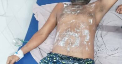 आकाशीय बिजली की चपेट में आने से युवक गंभीर रूप से झुलसा, जेब में रखा मोबाइल दो टुकड़ों में टूटा