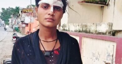 पुरानी रंजिश में मां-बेटी पर हमला, घर में घुसकर मारपीट का आरोप; थाने में नामजद तहरीर