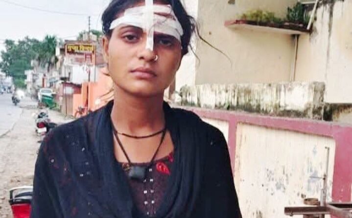 पुरानी रंजिश में मां-बेटी पर हमला, घर में घुसकर मारपीट का आरोप; थाने में नामजद तहरीर